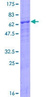 12.5% SDS-PAGE Stained with Coomassie Blue.